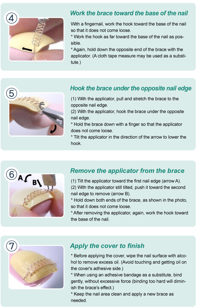 how to use pincer nail correction