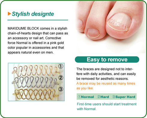 quality of pincer nail correction